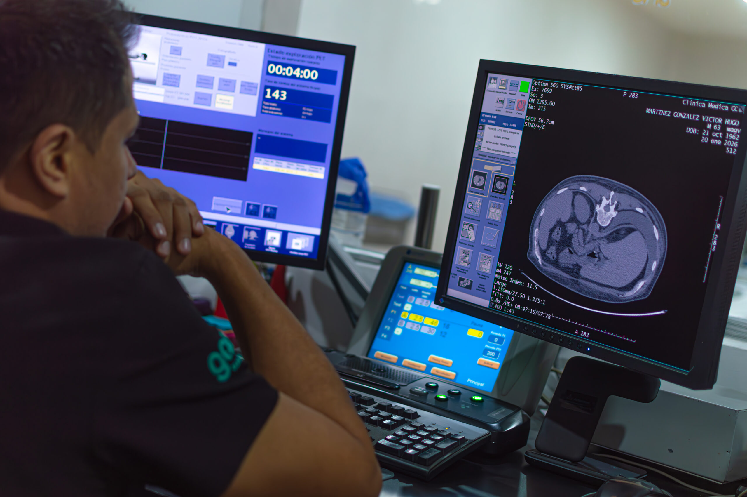 Medicina Nuclear GOCA