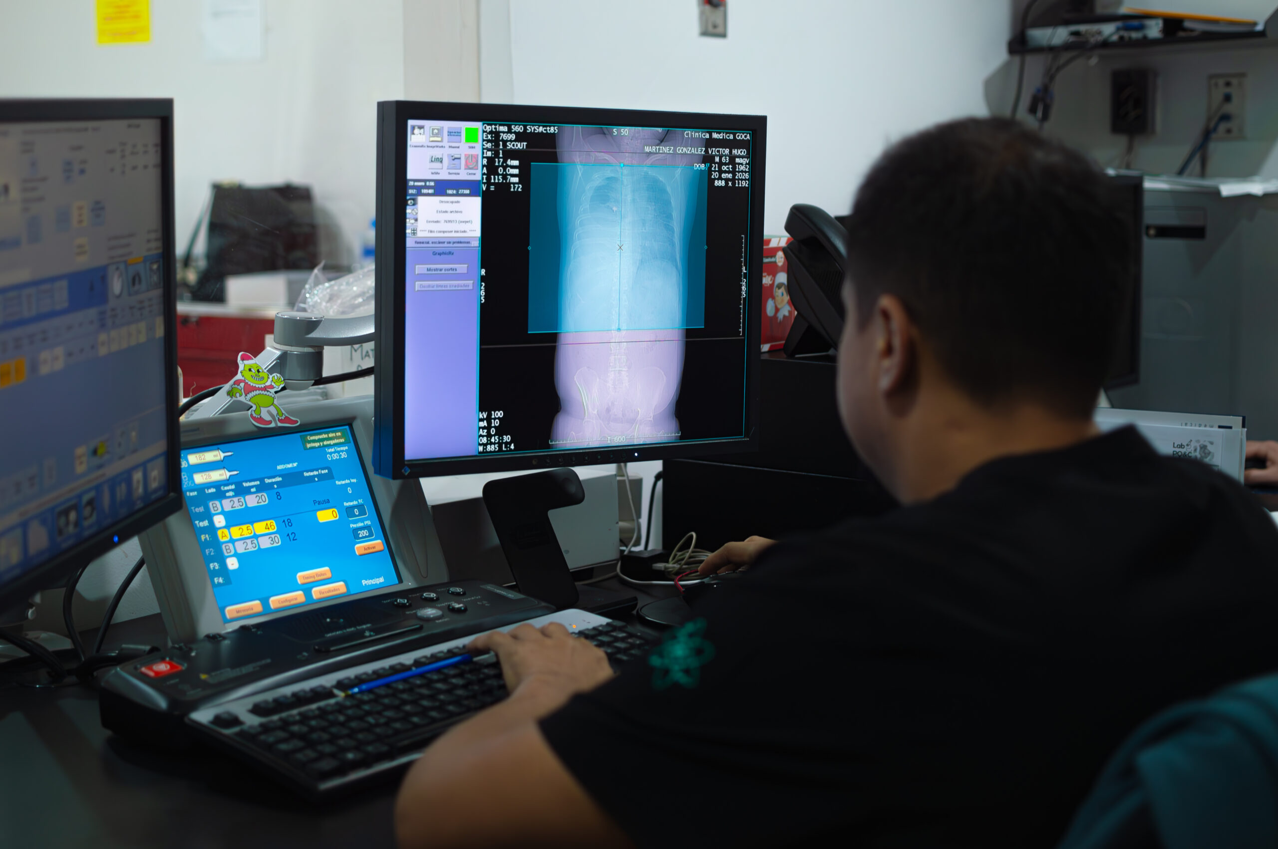 Biopsia guiada por PET/CT