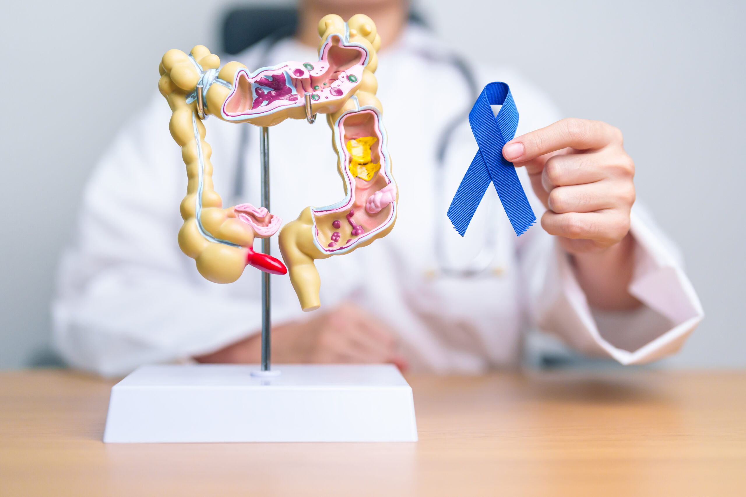 PET CT en oncología de alta precisión