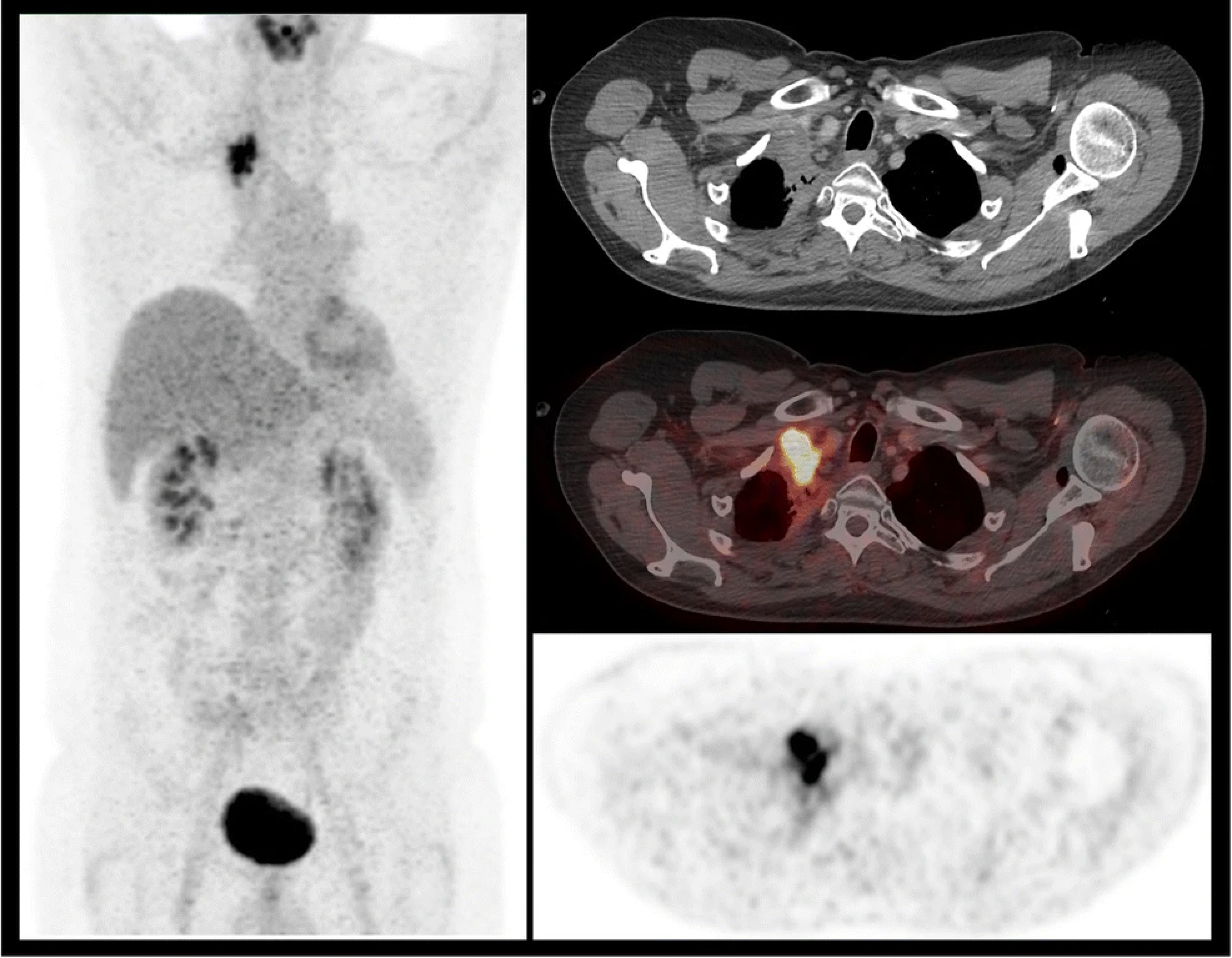 Adquisición de imágenes con PET/CT y SPECT/CT