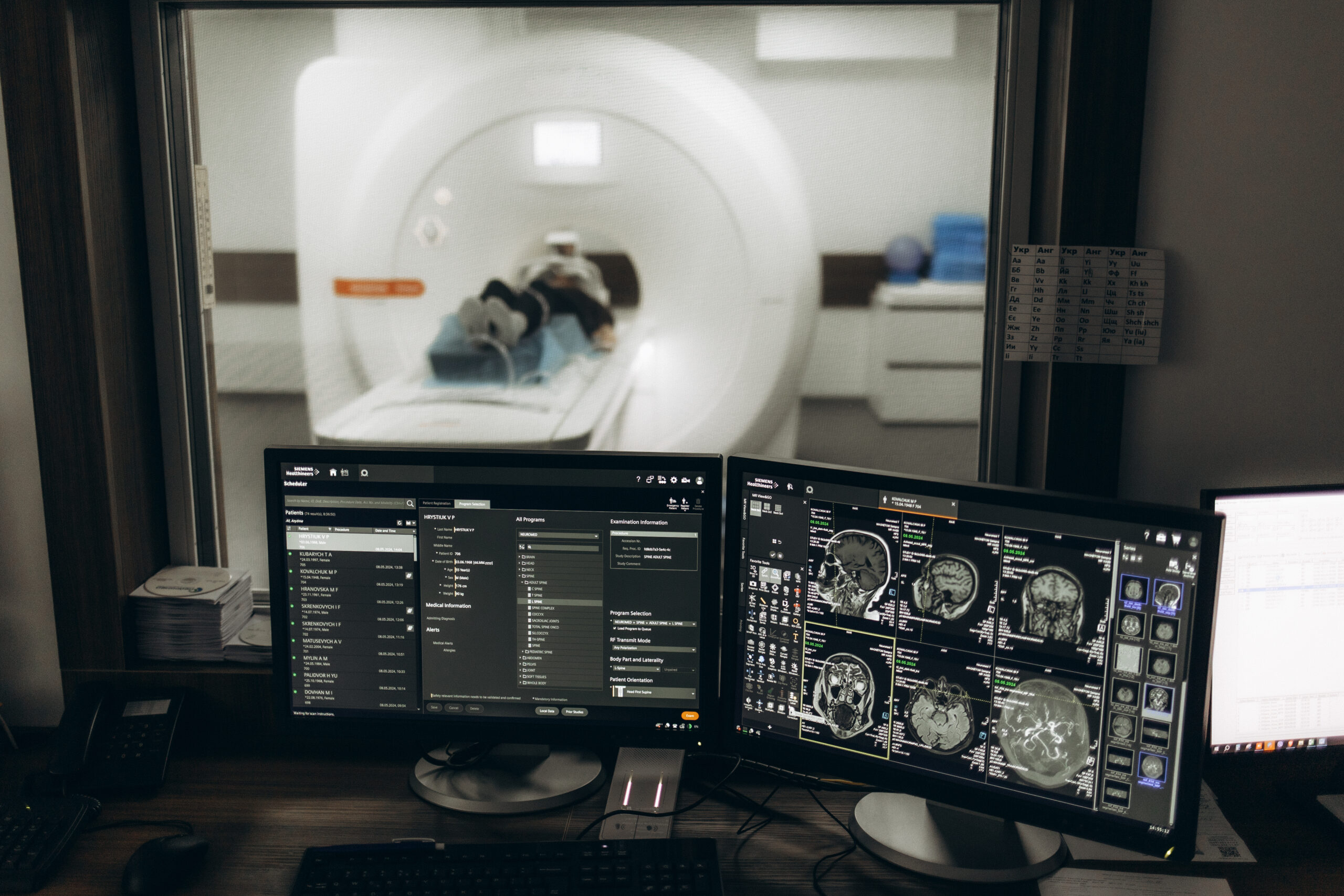 Estudio PET/CT en oncología